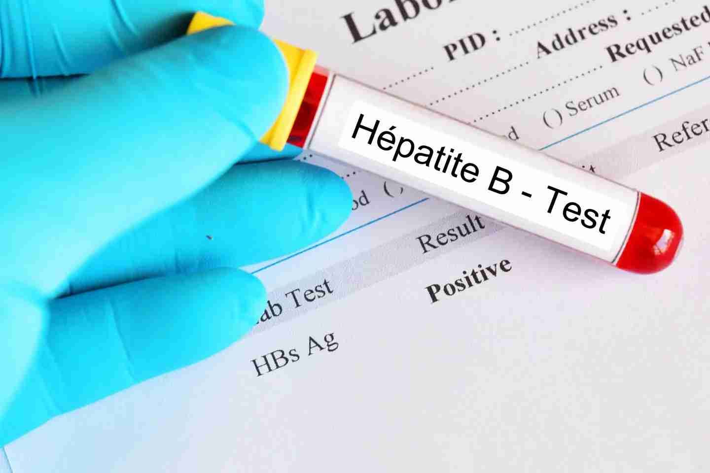 Prévention de l'Hépatite B